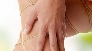 Perché appaiono le vene varicose sulle gambe